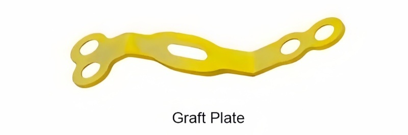 Posterior Cervical Laminoplasty System -CnOrtho