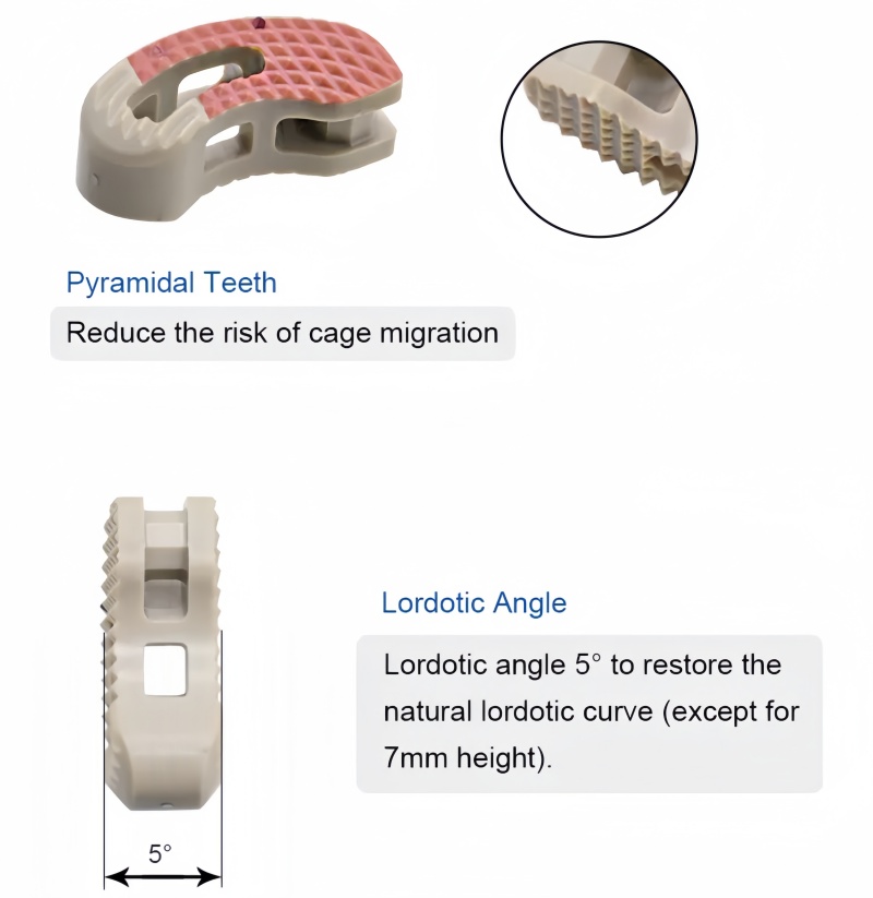 T-PAL Peek Cage-CnOrtho