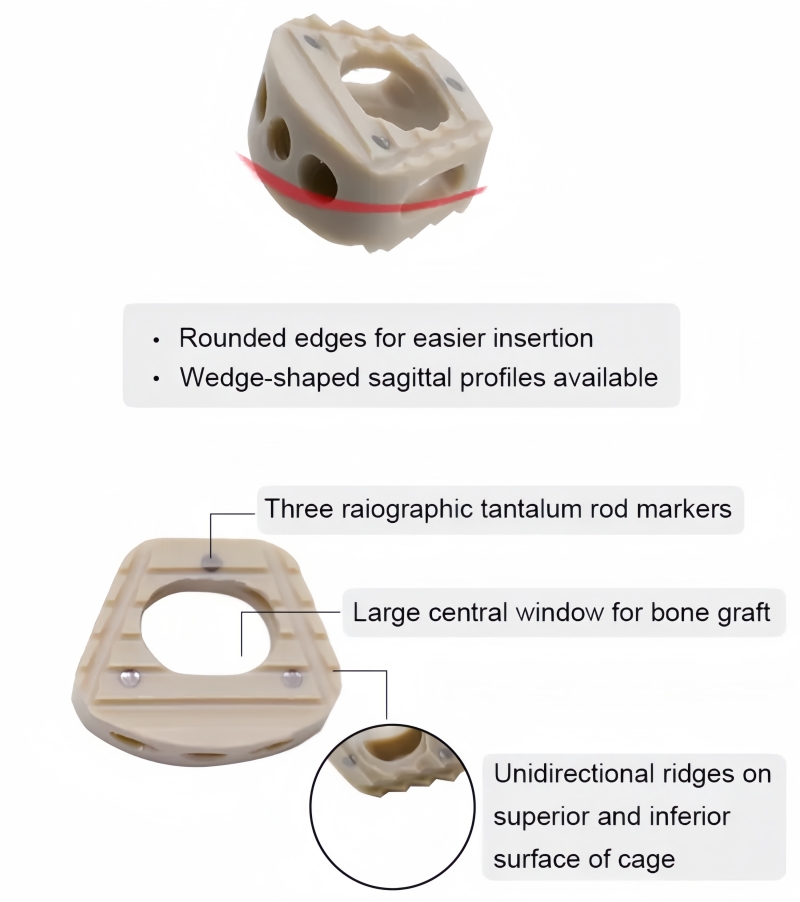 Cervical Peek Cage-II-CnOrtho