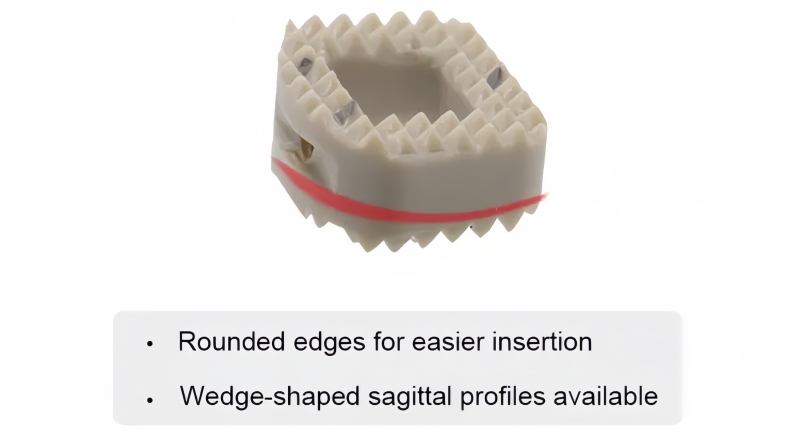 Cervical Peek Cage -CnOrtho
