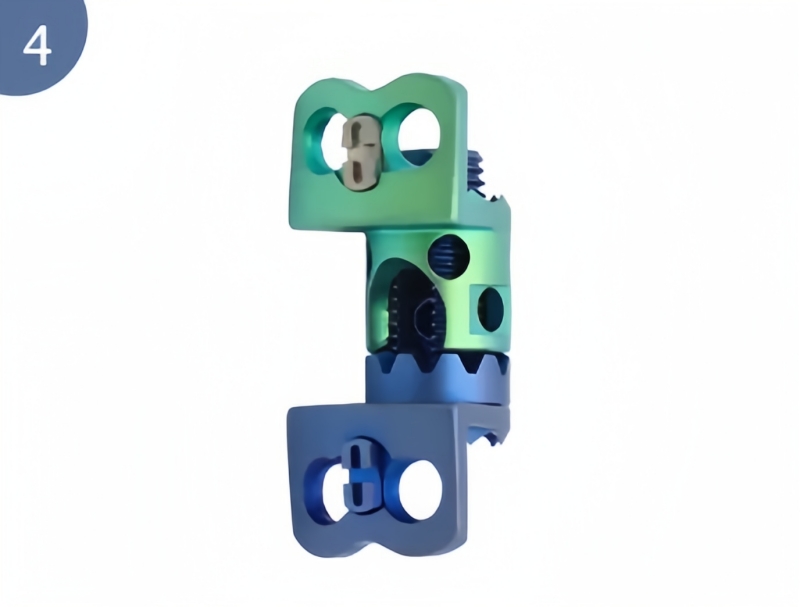Expandable Titanium Cage-CnOrtho