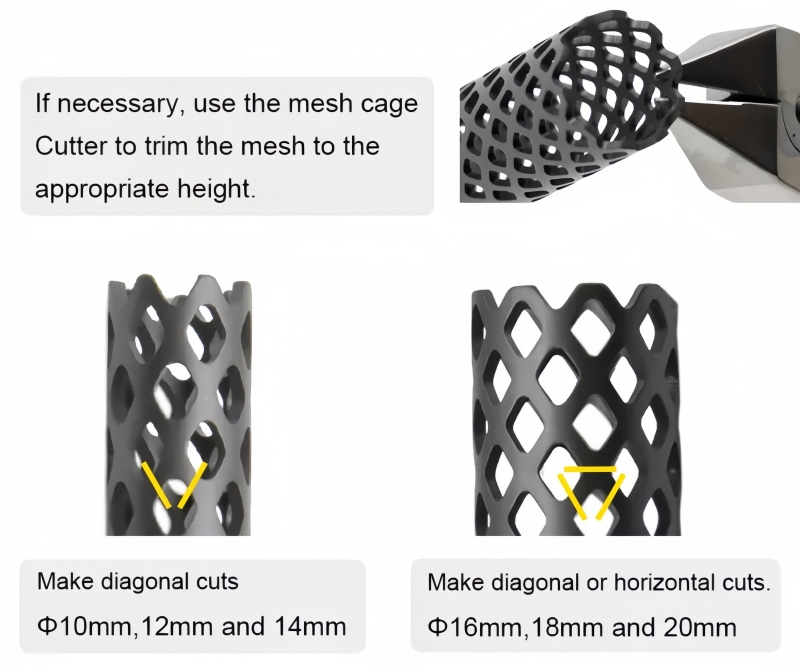 Titanium Mesh Cage-CnOrtho
