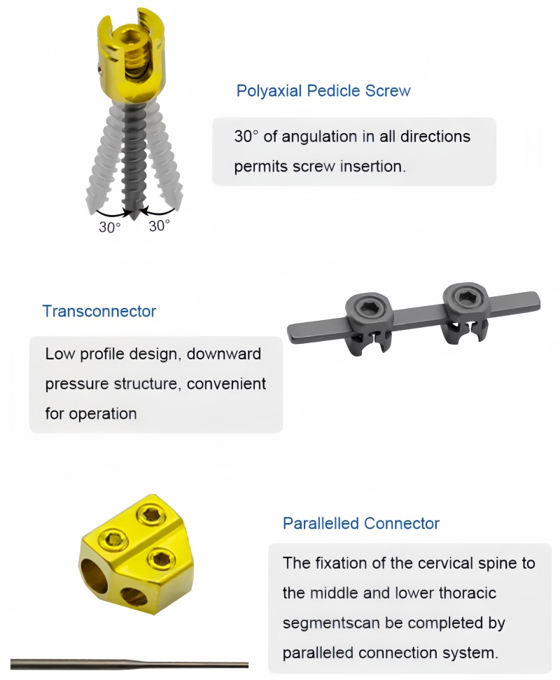 Posterior Cervical Screw System -CnOrtho