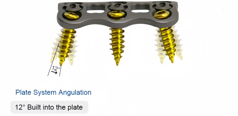 Anterior Cervical Plate-I-CnOrtho
