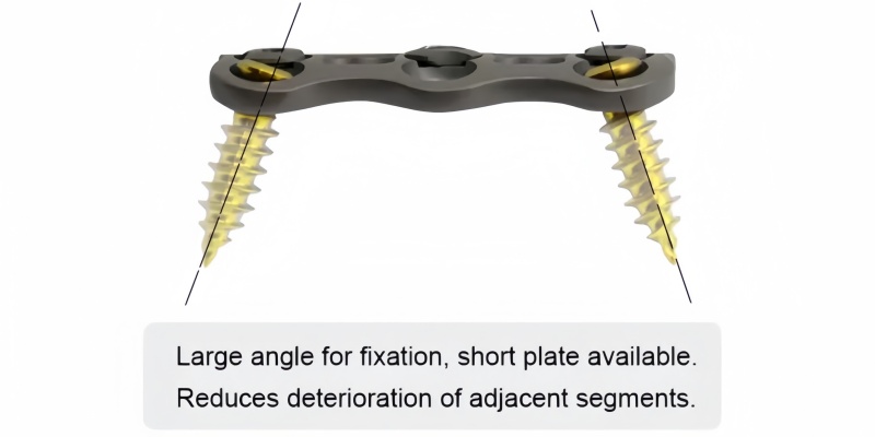 Anterior Cervical Plate-I-CnOrtho