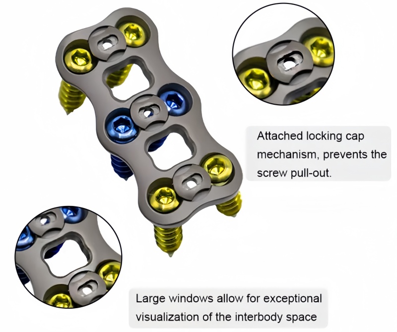 Anterior Cervical Plate-I-CnOrtho