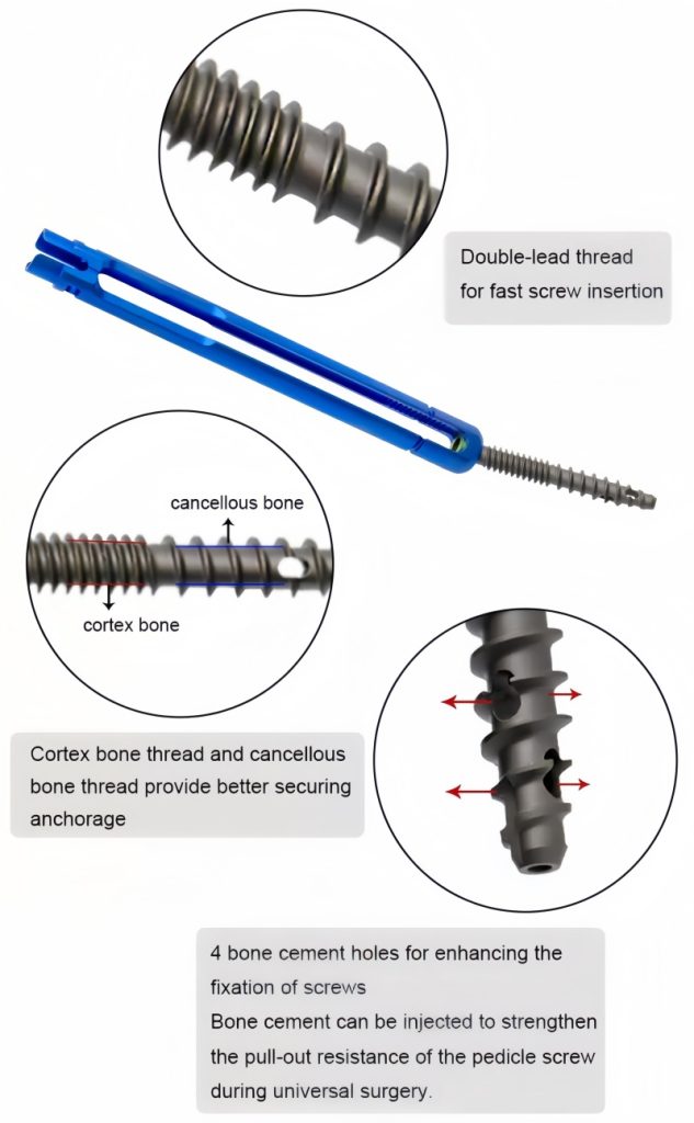 5.5 Minimally Invasive Pedical Screw-CnOrtho