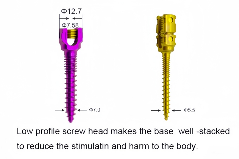 5.5 Spinal Pedicle Screw System -CnOrtho
