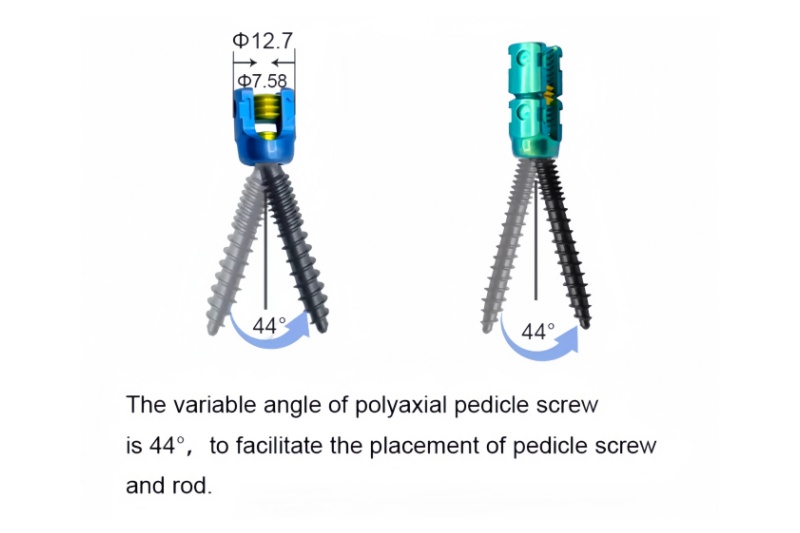 5.5 Spinal Pedicle Screw System -CnOrtho