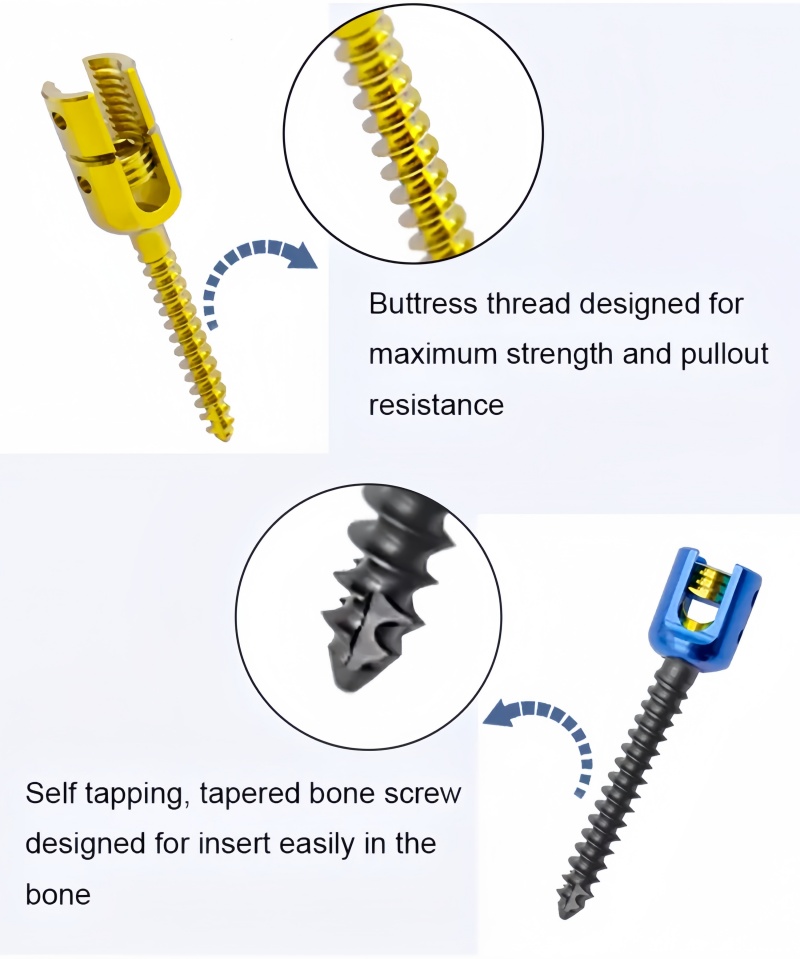 6.0 Spinal Pedicle Screw System-CnOrtho
