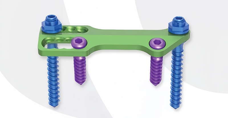 Anterior Thoracolumbar Plate System-CnOrtho