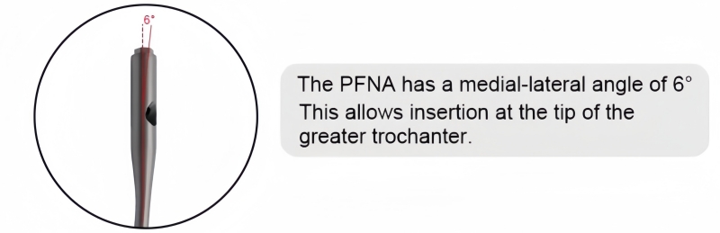 PFNA Nail-CnOrtho