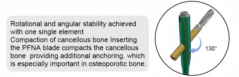 PFNA Nail-CnOrtho