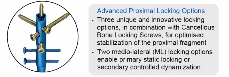Expert Tibia Nail-CnOrtho