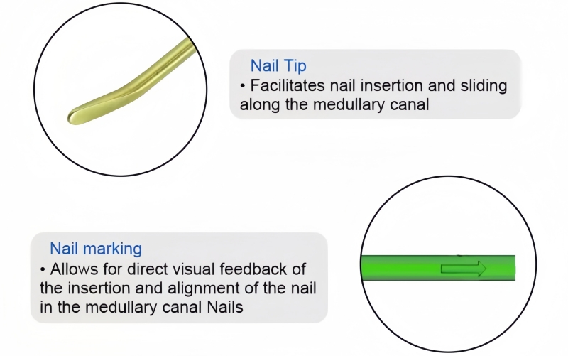 Titanium Elastic Nail-CnOrtho