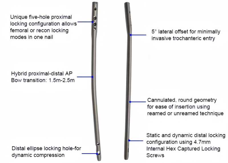 Expert Femoral Nail-CnOrtho