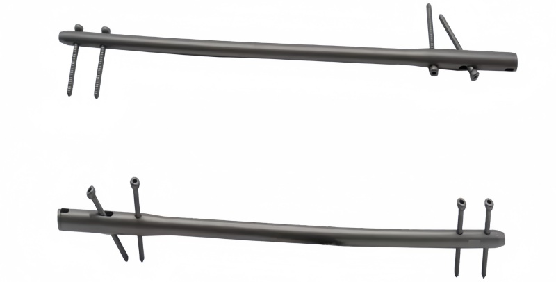 Femur Nail-CnOrtho